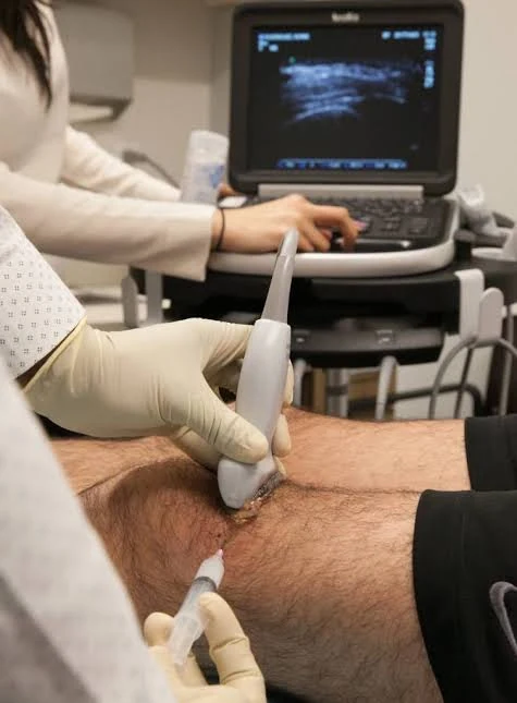 Ultrasound-guided platelet growth factor injection